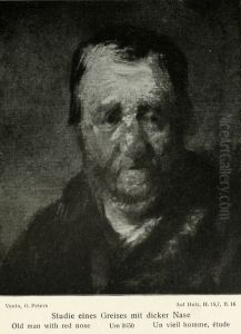 Study of a man with a swollen nose