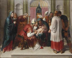 The Circumcision of Christ