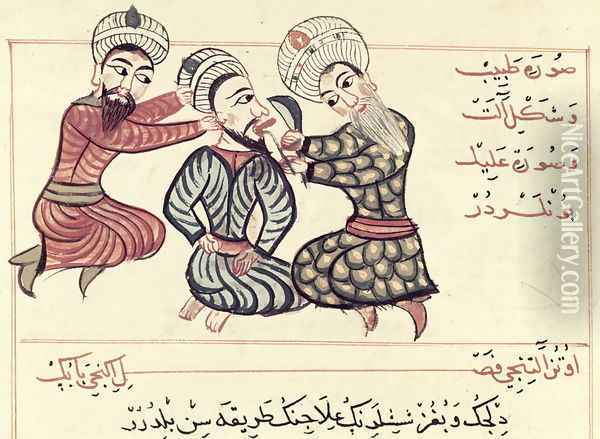 Ms Sup Turc 693 fol.76v Excision of a ranula from under the tongue, 1466 Oil Painting - Charaf-ed-Din