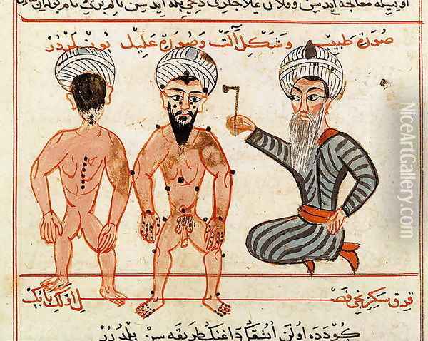 Ms Sup Turc 693 fol.46v Cauterisation of leprosy lesions, 1466 Oil Painting - Charaf-ed-Din