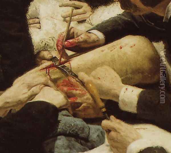 The Gross Clinic (detail) Oil Painting - Thomas Cowperthwait Eakins
