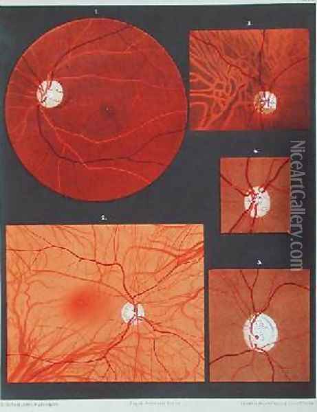The eye seen through a microscope Oil Painting - Liebreich, Richard