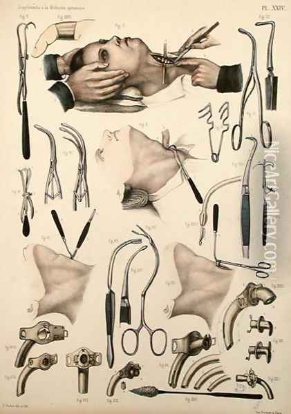 Tracheotomy operation, plate from Traite Complet de lAnatomie de lHomme by Jean-Baptiste Marc Bourgery 1797-1849 1866-67 2 Oil Painting - E. Pochet