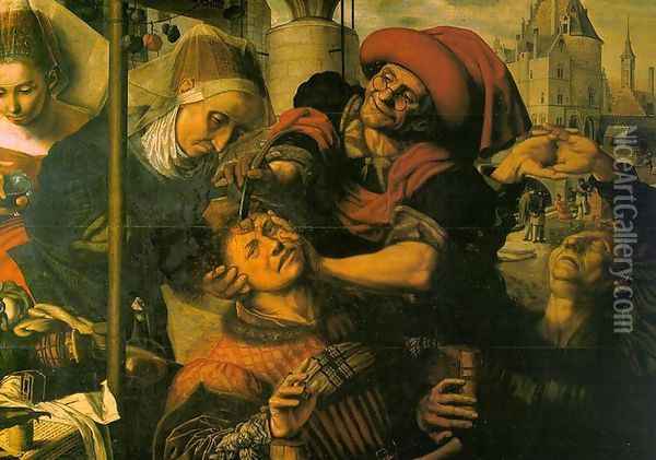 The Surgeon c. 1555 Oil Painting - Jan Sanders Van Hemessen