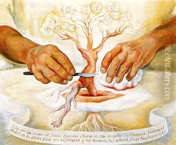 The Hands of Dr Moore (Los manos del Dr Moore) 1940 Oil Painting - Diego Rivera