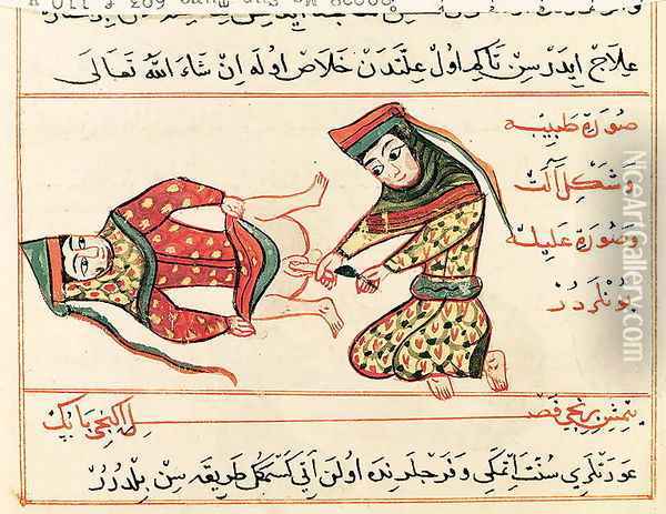 Ms Sup Turc 693 fol.110v Midwife operating on a hermaphrodite, 1466 Oil Painting - Charaf-ed-Din